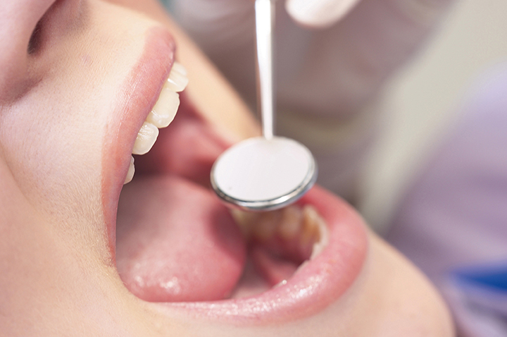 歯を根本から守る「予防」の重視